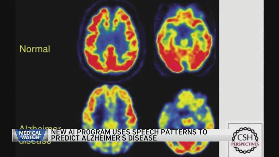 New AI program uses speech patterns to predict Alzheimers Disease  and more [Video]