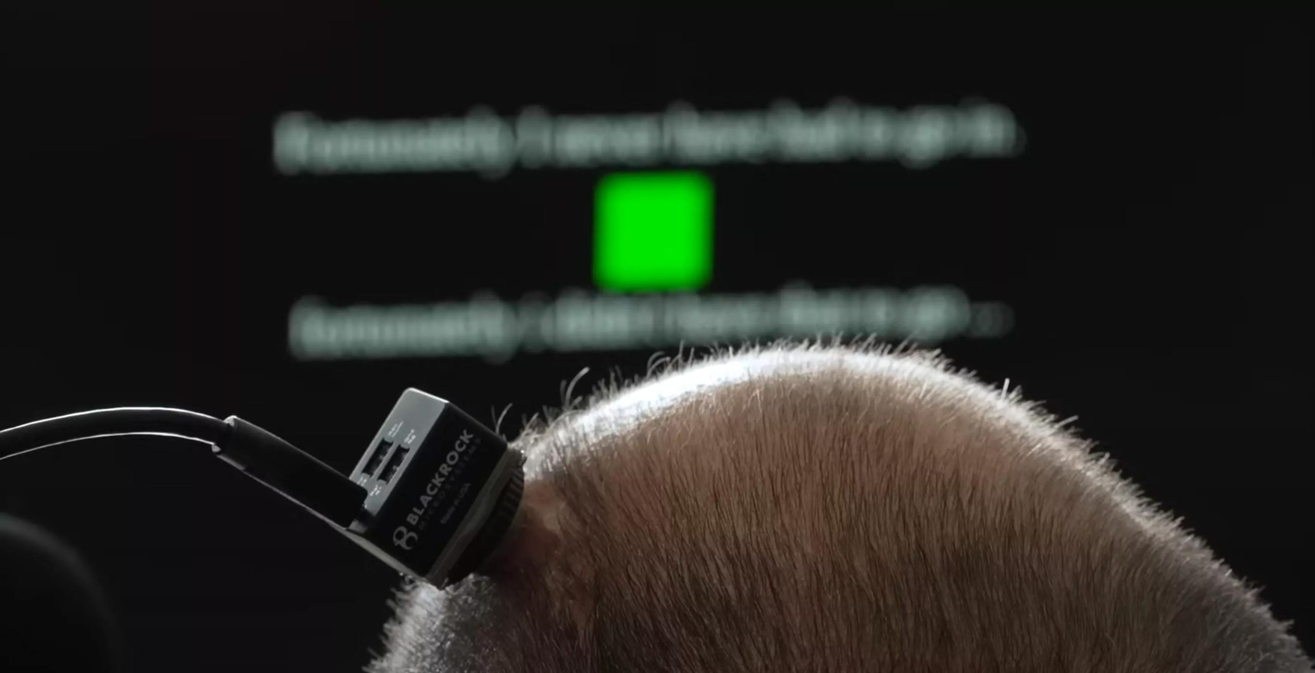 UC Davis researchers debut highly accurate brain-to-speech technology [Video]