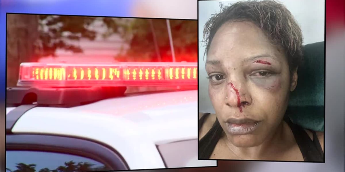 Woman says she took an Uber to the hospital after police didn’t respond following an assault [Video]