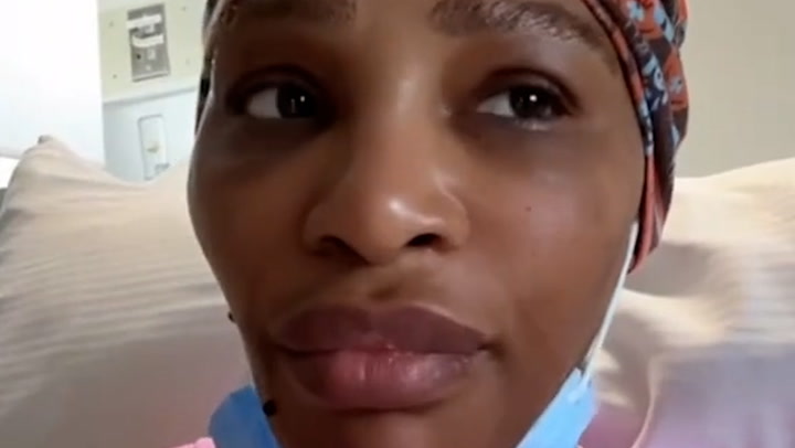 Serena Williams reveals grapefruit-sized cyst removed from her neck | Sport [Video]