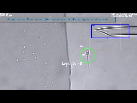 BAIBYS Announces a Breakthrough in Fertility Treatment with a Newly CE Marked IVF System [Video]