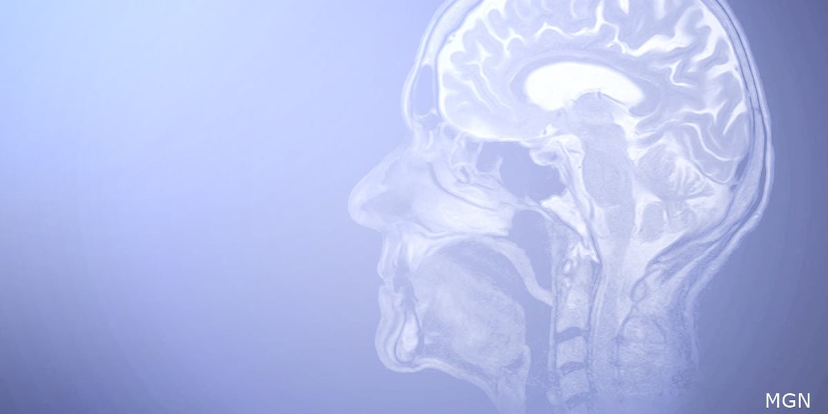 3 BRILLIANT MINUTES: A new way to detect strokes [Video]